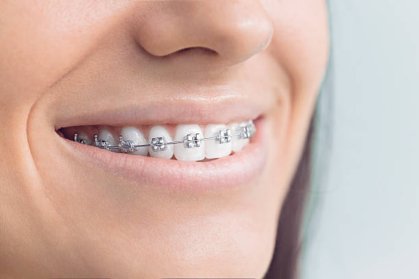 Best Invisalign and Clear Aligners  in Albion, NY